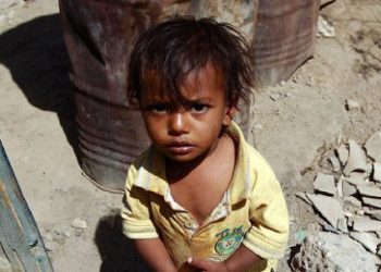 Yemen’de 85 bin çocuk açlık veya hastalık yüzünden öldü