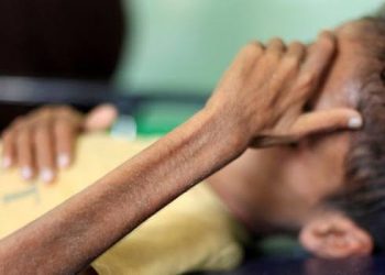 Yemen’de 85 bin çocuk açlık veya hastalık yüzünden öldü