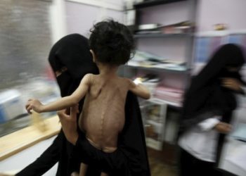 Yemen’deki durumu BM yetkilisi hatırlattı: Kıtlığın eşliğinde