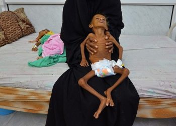 BM raporu: 24 milyon Yemenli insani yardıma muhtaç