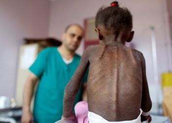 Nüfusu 29 milyon olan Yemen’de 22 milyon insan yardıma muhtaç